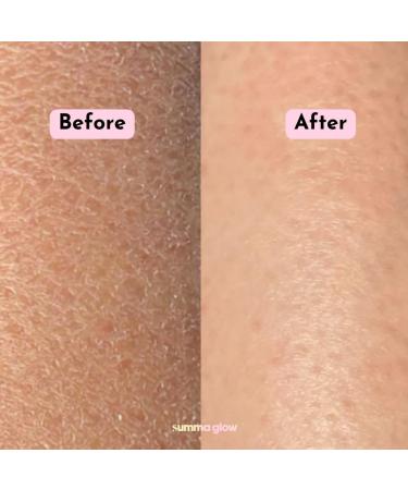 Summa Glow Deep Exfoliating Body Scrubber Mitt | Remove Dry Skin & Tan | Illuminating Shower Glove - Buy Online on GoSupps.com