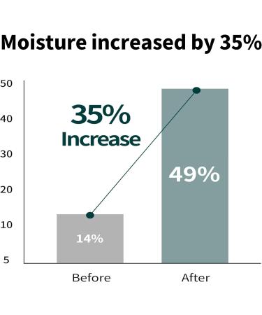  O'CLEARIEN Layered Toner Mist 5.24 fl. oz. | Trehalose for Hydrating Centella Asiatica for Soothing Anti-Aging Non-Irritating for Sensitive Skin Paraben Free Natural Extracts - Buy Online on GoSupps.com