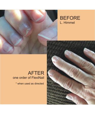 Penetrating Fingernail Conditioner & Strengthener | Repair Weak Peeling & Brittle Nails - 1 Bottle - International Shipping - Buy Online on GoSupps.com
