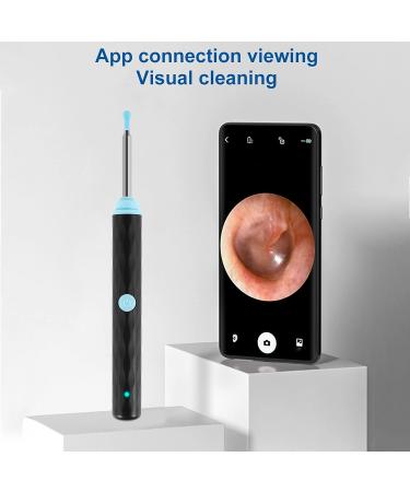 1296P HD WiFi Ear Wax Remover Kit with Camera - Waterproof Wireless Visual Ear Cleaner - Buy Online on GoSupps.com