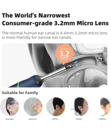1920P FHD WiFi Ear Wax Removal Kit with Camera for Adults Kids Pets - Blue - Buy Online on GoSupps.com