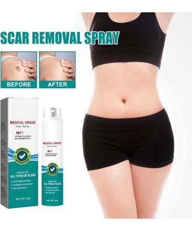 DUBUSH Scarremove Advanced Scar Spray - For Acne, Surgical Scars & Stretch Marks - Gentle Skin Care - 2pcs - Buy Online on GoSupps.com