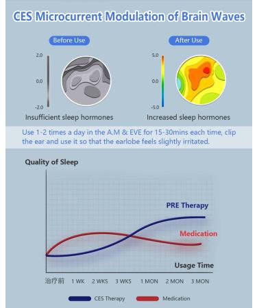 KTS 2.0 CES Sleep Aid Device | Relieve Insomnia Anxiety Depression & Headaches with Microstrom & Cranial Electrotherapy - Buy Online on GoSupps.com