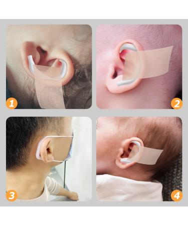 Corrector De Ojeras 5 Pairs Ear Corrector Silicone - White Invisible Tape for Valgus Correction and Flared Ears - Buy Online on GoSupps.com