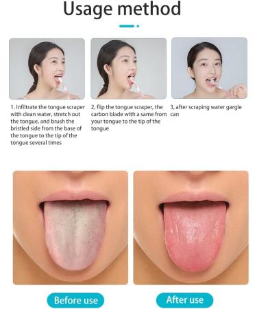 3-Piece Double-Sided Tongue Cleaning Brush Set - Gentle & Effective Tongue Scrapers in Green Blue & Pink for Bad Breath Relief - Buy Online on GoSupps.com