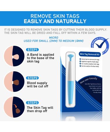Skin Day Remover Kit - 40 Ligaments & 36 Repair Patches for Small to Medium Skin Tags - Buy Online on GoSupps.com