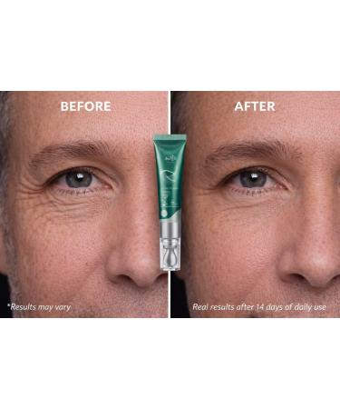 Rejuvenating Anti Aging Serum - Lifting Power Eye Fluid - Hydrating Eye Wrinkle Cream for Women with 5 Peptides & Vitamins - Ceramide Hyaluronic Acid Vitamin C Palmitoyl Tripeptide-1-15ml - Buy Online on GoSupps.com