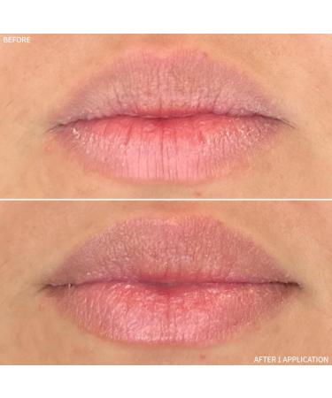 RescueMD Restorative Lip Treatment Peptide-Powered Rejuvenation + Arnica Repair for Healthy Hydrated Lips (12mL) - Buy Online on GoSupps.com