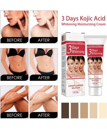 HSJJ 3 Day Kojic Acid Whitening Moisturizing Cream Dark Spot Corrector Cream Kojic Acid Cream Skin Lightening Cream Skin Bleaching Cream for Face and Body 2pcs - Buy Online on GoSupps.com