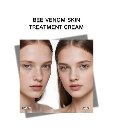2Pcs Bee Venom Multi Skin Treatment Cream Bee Venom Skin Treatment Cream Gentle bee venom Moisturizing Cream for All skin Types - Buy Online on GoSupps.com