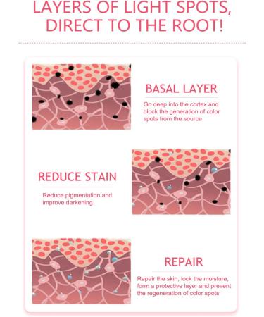 Face Freckle Removal Cream 0.7oz Nicotinamide Freckle Removal Cream Face Brightening Hydrating Nourishing Repairing Freckle Cream - Buy Online on GoSupps.com