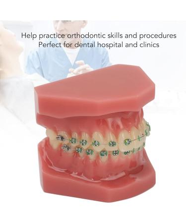 Orthodontic Bracket Model - Dental Resin Model & Portable Metal Wire for Student Learning - Buy Online on GoSupps.com