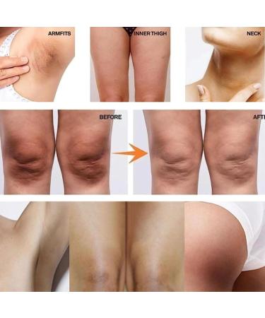 (100% Effective) 5PCS | | | | | | | | 30ml - Buy Online on GoSupps.com