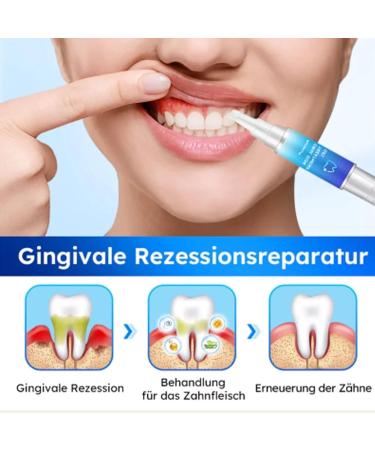 Oral Gel for Gum Treatment Gum Gel Gum Treatment Gel Gum Protection Therapy Gel for Gum Restoration and Teeth Whitening (8PC) - Buy Online on GoSupps.com