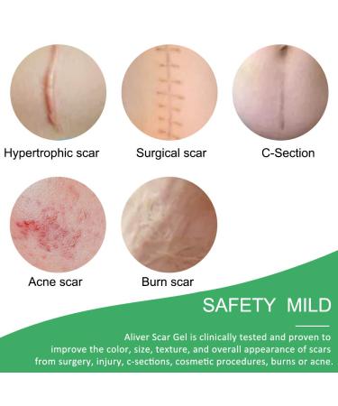 Silicone Scar Sheets for C-Section Surgery, Burns, Keloids, Acne & More - 4 Reusable Strips - 2 Months Supply - Buy Online on GoSupps.com