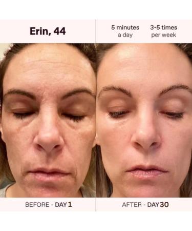 Red Light Therapy Face & Neck Anti-Aging Device | 4-in-1 LED Massager for Skin Rejuvenation & Care | Portable Home Therapy Wand - Buy Online on GoSupps.com