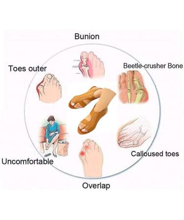 Women s Comfort Flat Sandals | Breathable Bunion Corrector Clip Toe Shoes | Animal Print Crocodile Pattern Beach Travel Sandals | Size 8 White - Buy Online on GoSupps.com