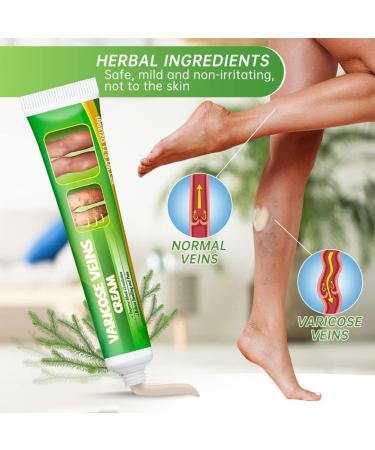  Katutude Repair cream for varicose veins and spider veins. Varicose vein cream to relieve varicose veins and spider veins. - Buy Online on GoSupps.com