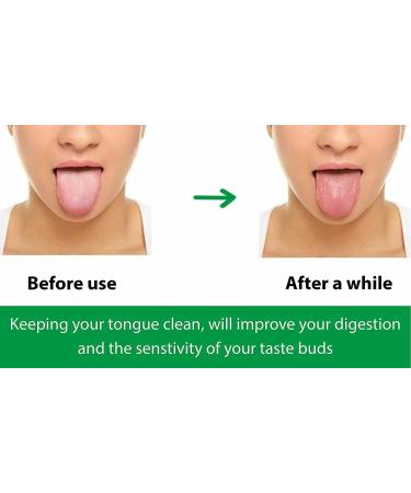 Wonder Care Yurveda Copper Tongue Cleaner Set of 2 | Ayurvedic Solution for Bad Breath - Buy Online on GoSupps.com