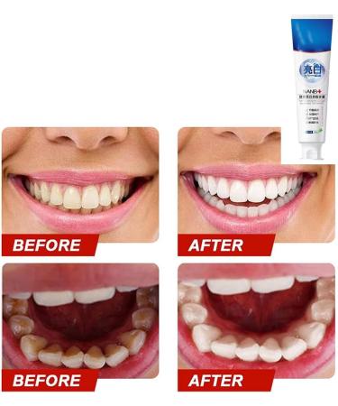 SP-4 Probiotic Whitening Toothpaste - Natural Brightening & Stain Removal - Fresh Breath (4 PCs) - International Shipping - Buy Online on GoSupps.com