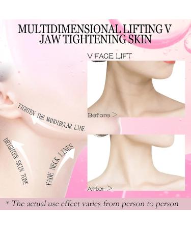 APPTI 5 Pcs Rosa Rugosa V-Line Lifting Bandage Mask for Women - Double Chin Reducer and Face Slimmer Mask with Chin Up Patch - V-Line Shaping for Cheek and Neck - Buy Online on GoSupps.com