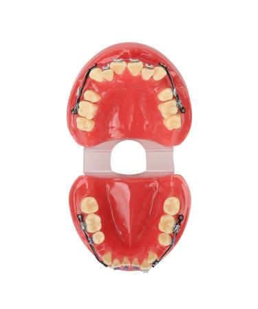 Orthodontic bracket model orthodontic demonstration model with metal wires and bracket design (24 teeth metal brackets)