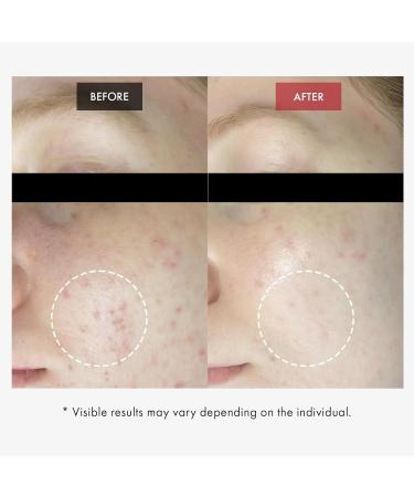 DR.WANT Red BHA Gel Daily Exfoliating Gel with AHA PHA LHA for Gentle Peeling Soothing Recovery Pore Care Hydration Tea Tree Cica for Blemish-prone skin. Korean Skincare 100g 3.52 oz. - Buy Online on GoSupps.com