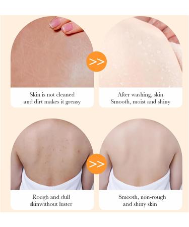 Papaya Goats Milk Soap Bar for Hyperpigmentation & Dark Spots - Vitamin C Face Wash for Clean Skin - Oil Control & Hydration - Buy Online on GoSupps.com