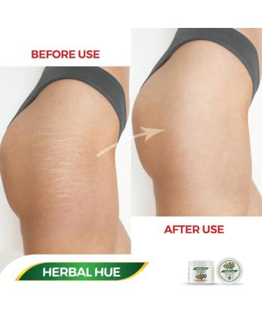 Herbal Hue 100% Natural Shea Butter 300ml Pure Raw Unrefined A Grade African Ivory All-Natural Smooth Shea Nut Body Butter Lip Balm Moisturiser Cream Lotion for All Skin Face Hair Type - Buy Online on GoSupps.com