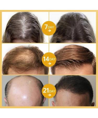 Raw Batana Oil - Natural Hair Restoration for Men & Women | Repair Dry Damaged Hair (3P - Buy Online on GoSupps.com