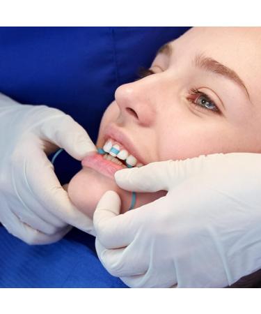 Dental Polishing Strips 4mm x 6M Fine (Blue) - 1 Count | Teeth Abrasive & Finishing Strips - Buy Online on GoSupps.com
