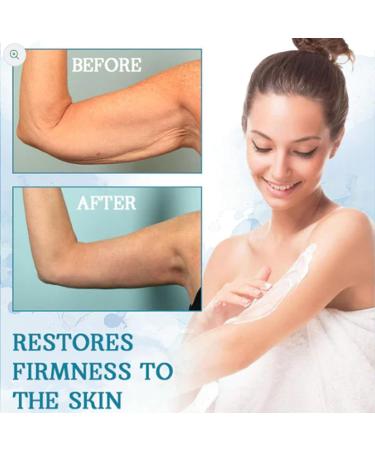 RENTANAC Luxelift Skin Firming Youth Butter Cream Luxelift Skin Firming Cream Skin Firming Body Butter Body Butter Anti Aging Moisturizer for Body Moisturizes Smoothing - Buy Online on GoSupps.com