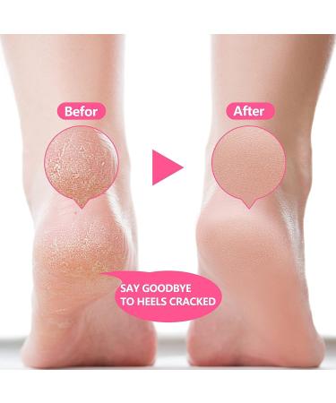 Gel Heel Protectors (4 Pairs) for Men & Women - Breathable Silicone Heel Pads for Pain Relief & Moisturizing - Plantar Fasciitis & Blisters Prevention - Buy Online on GoSupps.com