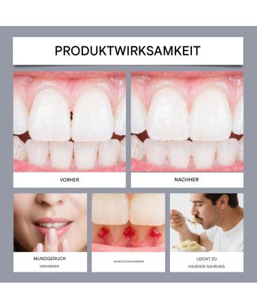 Dental prostheses bonding cream 20 g bond protection for dental prostheses extra strong bond fast bonding gel reduces gum complaints - Buy Online on GoSupps.com