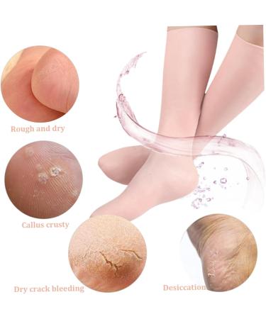 Moisturising Socks Elastic Silicone Socks for Women Comfortable Overnight Gel Socks Reusable Foot Moisturiser Socks for Repairing Dry Feet Cracked Heel Skin Color - Buy Online on GoSupps.com