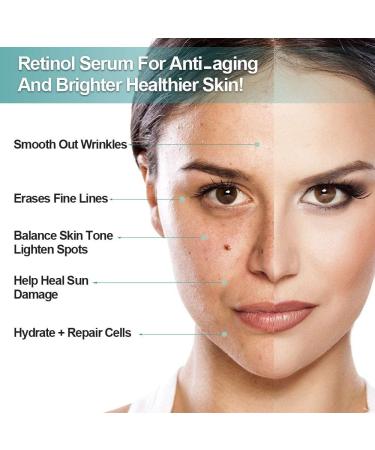 Retinol Serum Retinol Liposome Delivery System with Hyaluronic Acid and Vitamin E Aloe Anti Aging Retinol Serum for Skin Repair Brighten Your Look Fine Line and Wrinkles - Buy Online on GoSupps.com