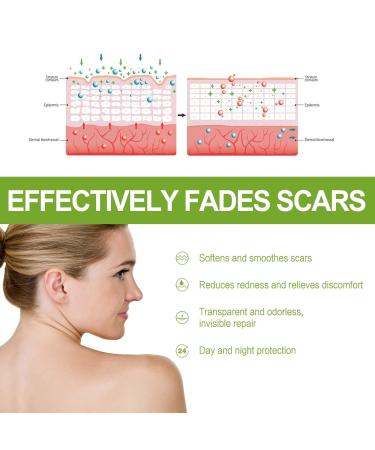Goopgen Medical Grade Scar Repair Serum - Advanced Proregen Formula for All Types of Scars - Buy Online on GoSupps.com