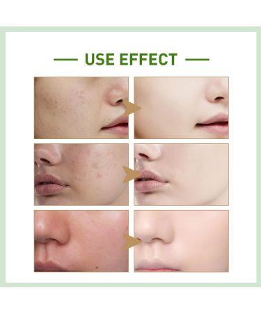 Aloe Vera Face Toner Moisturizing Spray Make Up Setting Spray for Face Aloe Facial Spray for Acne Prone Skin Hydrating Face Mist for Dry Skin Makeup Face Mist Nourishing Dry Skin & Relieve Acne -150ml - Buy Online on GoSupps.com