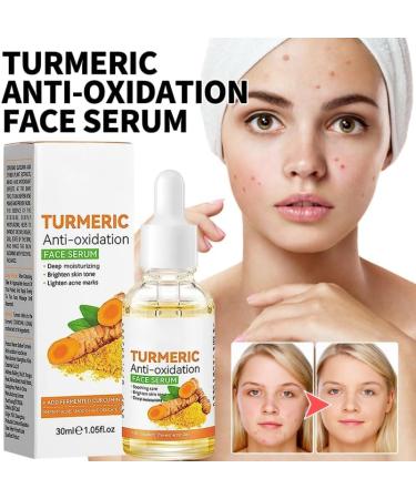 COALHO 2023 New Turmeric Dark Spot Serum Oil Turmeric Antioxidation Serum Turmeric Face Serum Oil Bright Skin Dark Spot Corrector Face Serum Turmeric Serum for Dark Spots 3 pieces - Buy Online on GoSupps.com