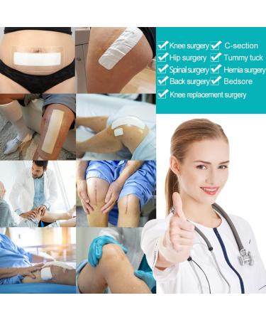 C-Section Waterproof Bandages | Post Hysterectomy & Tummy Tuck Shower Protector | Scar Cover & Wound Care Supplies | 4x10 Inch Pack of 14 - Buy Online on GoSupps.com