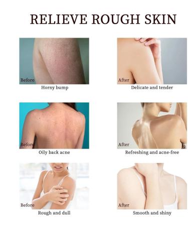 Soothing body lotion natural skin care products naturally soothing skin care gel Mild body care products deep cleansing lotion for neck back arms - Buy Online on GoSupps.com