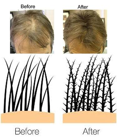 Volumon Professional Hair Building Fibres- Hair Loss Concealer- COTTON- 12g- Get Upto 30 Uses- CHOOSE FROM 8 HAIR SHADES COLOURS (Black) - Buy Online on GoSupps.com