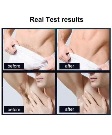 Hair Clippers for Sensitive Areas - Rechargeable IPX7 Electric Body Trimmer & Painless Epilator for Men - Buy Online on GoSupps.com