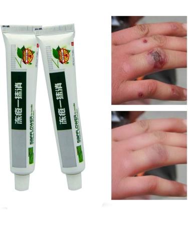 Helloyoung Chinese Healing Ointment | Hand & Foot Cream for Cracked Heels Frostbite & Dry Skin - Wholesale First Aid Solution - Buy Online on GoSupps.com