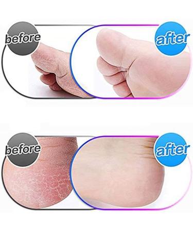 8 Pack Extra Coarse Replacement Rollers for Amope Pedi - Hard Skin Remover Refills with Nail Brush and Clean Brush - Buy Online on GoSupps.com