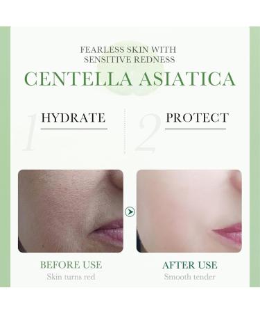 Centella Calming Gel Cream Face Moisturiser for Acne Prone Skin Sensitive Oily Dry Skin Face Moisturizer for Women with Tea Tree Oil Korean Skincare Korean Moisturiser (1 Piece) - Buy Online on GoSupps.com