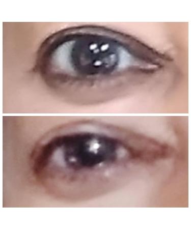 Brightnening Eye Serum with Niacinamide (vitamin B3). Powerful Eye Treatment Serum-Advanced Formula Anti-aging Visibly Rapid Wrinkle Reduction and Crow feet (30 ml) - Buy Online on GoSupps.com