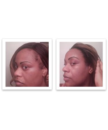 Caboki Hair Concealer Travel Size Black - All-Natural Hair Building Fibers - Buy Online on GoSupps.com