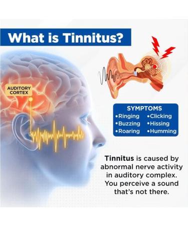 Acupeace Tinnitus Relief Device Auricalm Tinnitus Relief Device Tinnitus Relief for Ringing Ears Tinnitus Ear Cuff Set Stop Ear Ringing (1Pair) - Buy Online on GoSupps.com