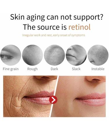 Harvey Ross Miracle Retinol Harvey Ross Miracle Retinol Moisturizer Harvey Ross Anti-Wrinkle Face Cream Reduces Wrinkles And Firms Skin Anti-Aging Face Moisturizer - Buy Online on GoSupps.com